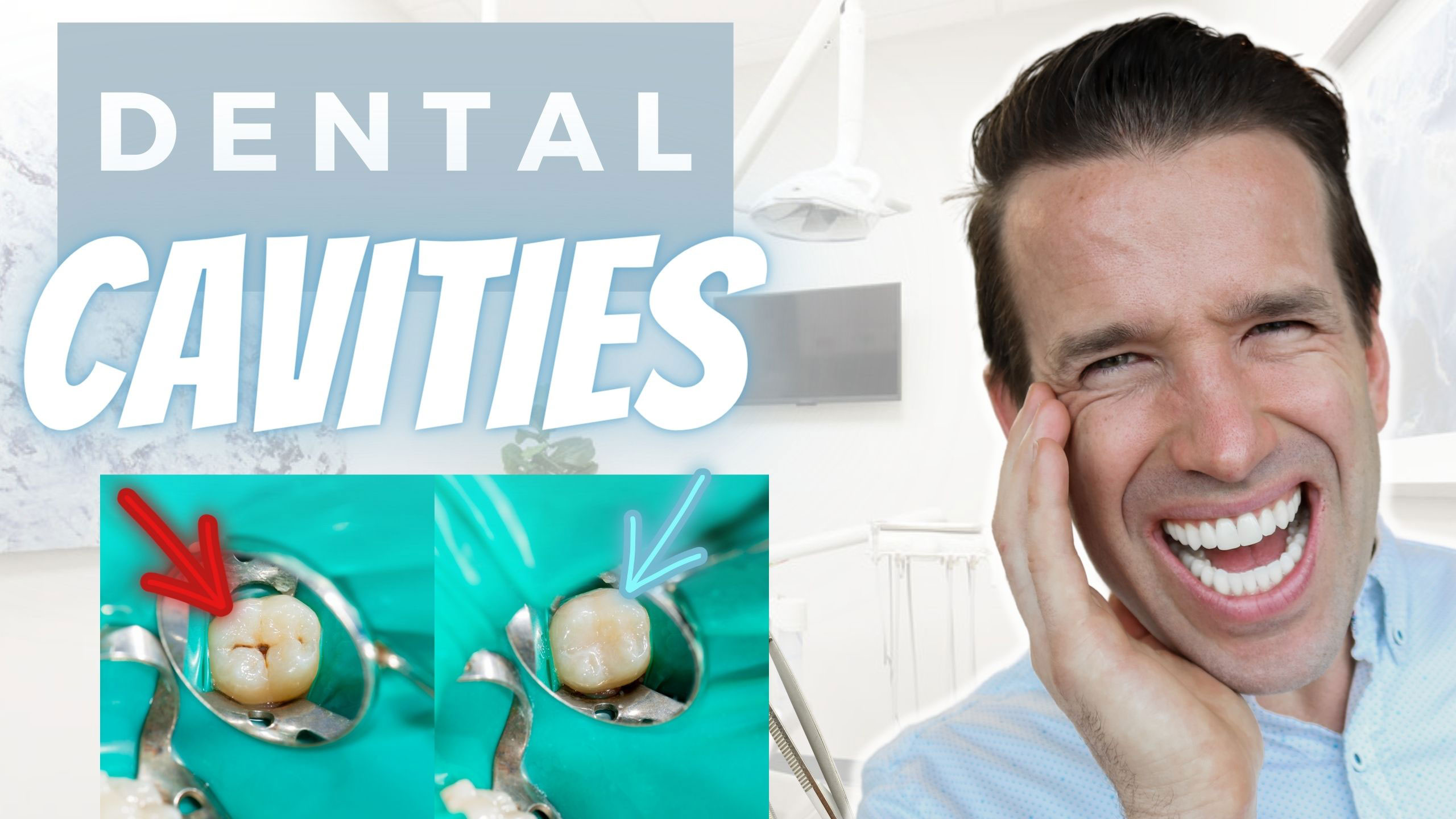 dental cavities