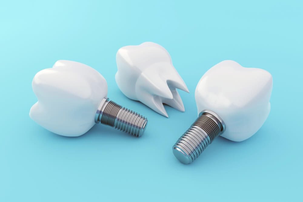 Tooth Implants and Tooth Crown 3d render